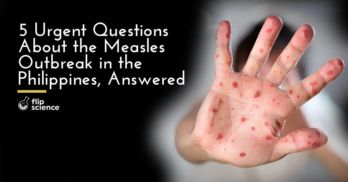 5 urgent questions about the Philippine measles outbreak, answered